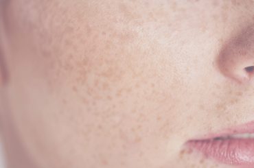 Treatments for sensitive skin at Intermezzo Salon & Spa in Seattle